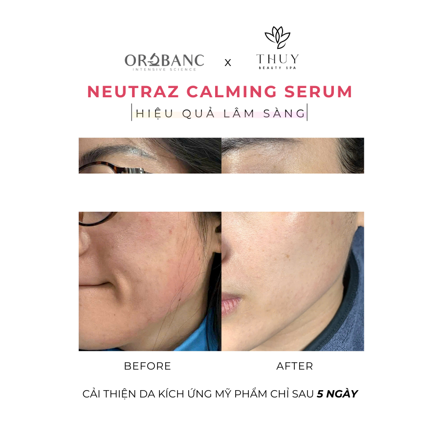 web_TotalStrengthSerum_10ml_1200x1200